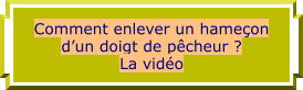Comment enlever un hameçon d’un doigt de pêcheur ? La vidéo